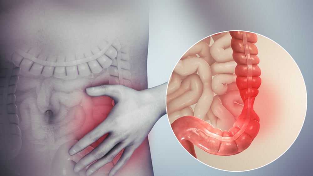 7 نصائح مهمة هتخلصك من مشاكل القولون للأبد.. تعرف عليها