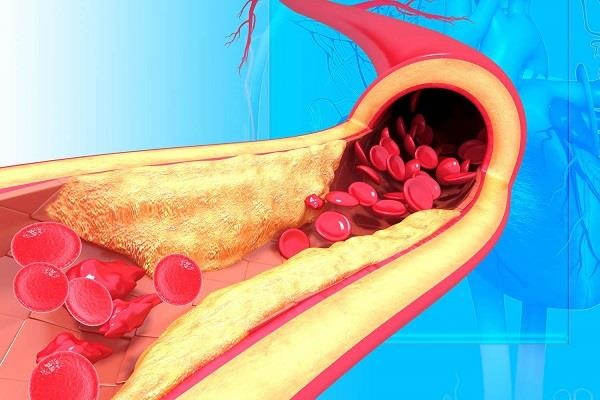 اكتشف نوع من الخضروات لذيذ يقلل مستويات الكوليسترول الضار بالجسم