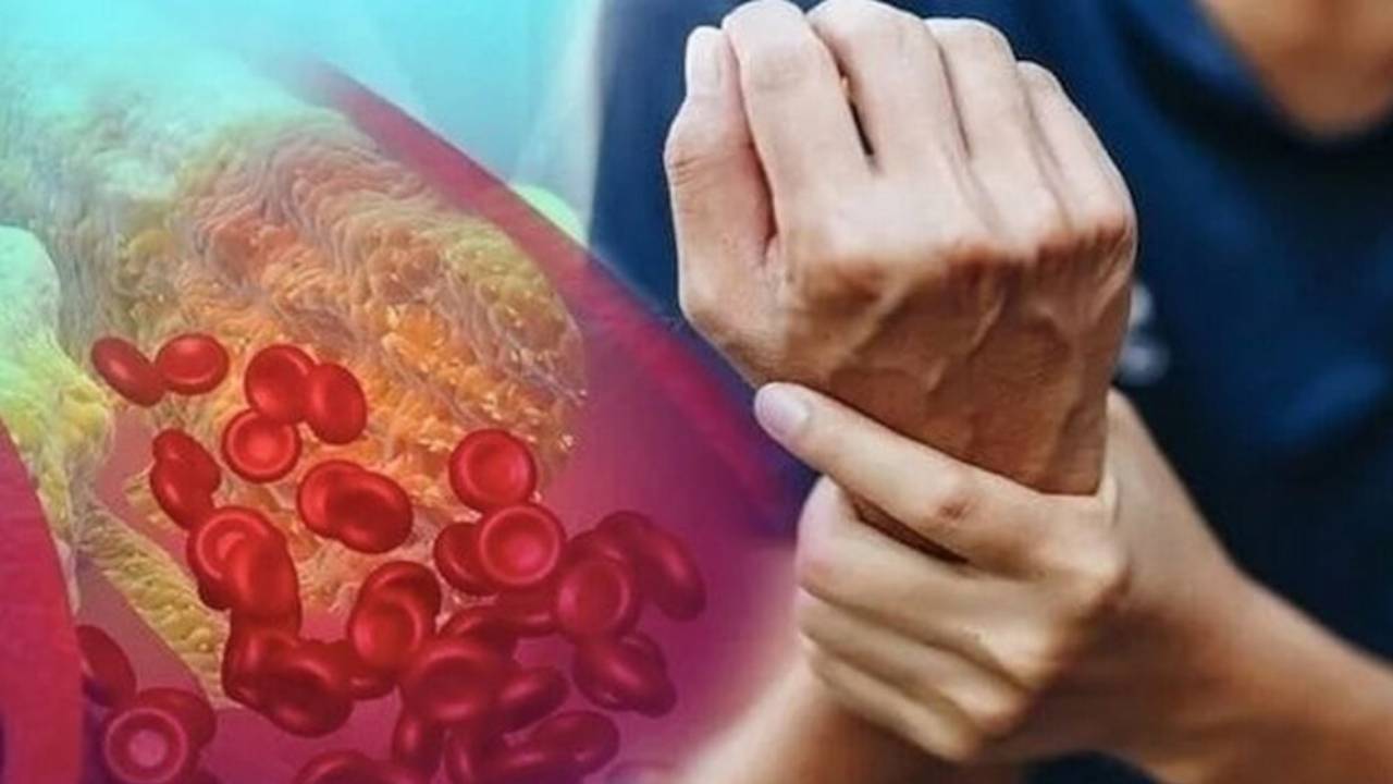 طبيب سعودي يكتشف عن عشبة منتشرة ورخيصة تخفض الكوليسترول وتقوي المناعة وفوائد أذهلت الأطباء !