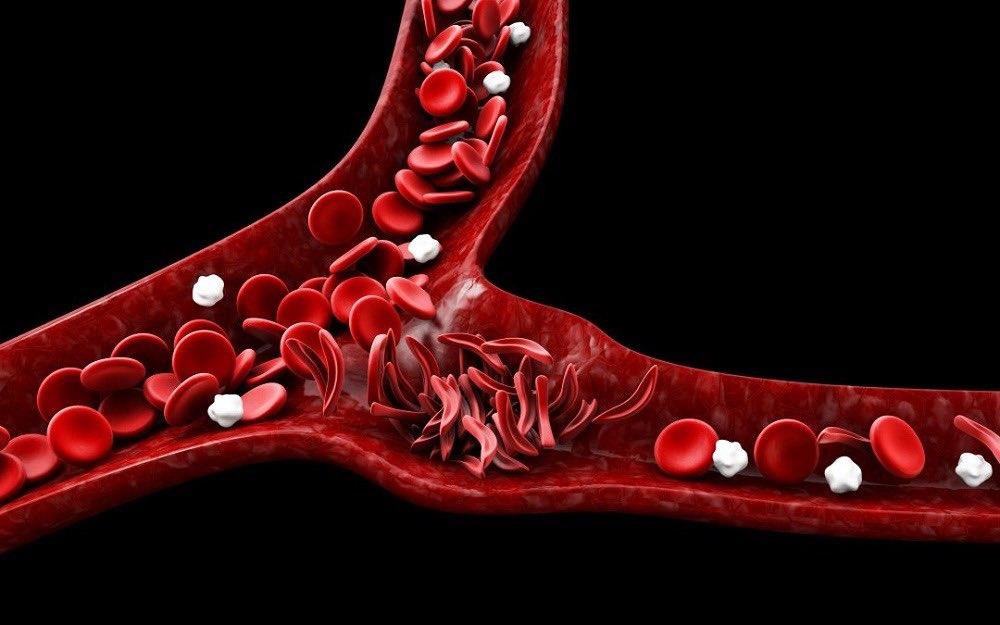 طبيب يكشف 10 أعراض تكشف الإصابة بمرض القلب.. تعرف عليها