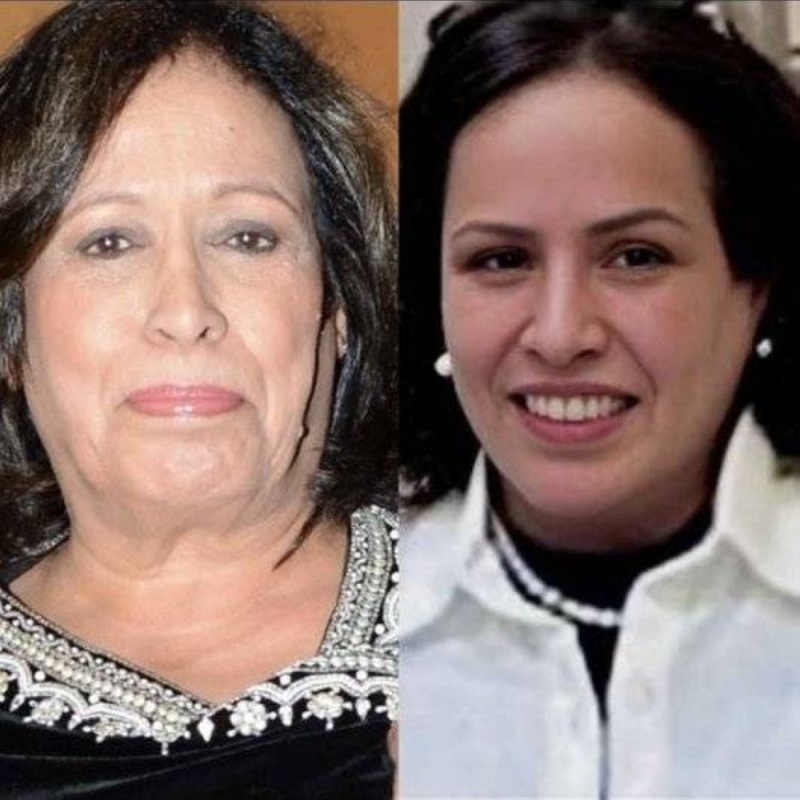 أول تعليق من الفنانة حياة الفهد بشأن الصورة المتداولة لها وتظهر خضوعها لعملية تجميل