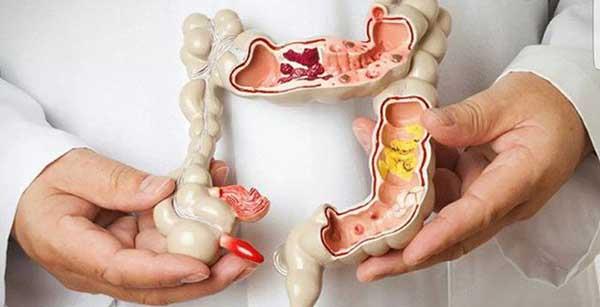 5 علامات أولية لنوع سرطان خطير.. وهل يمكن علاجه؟