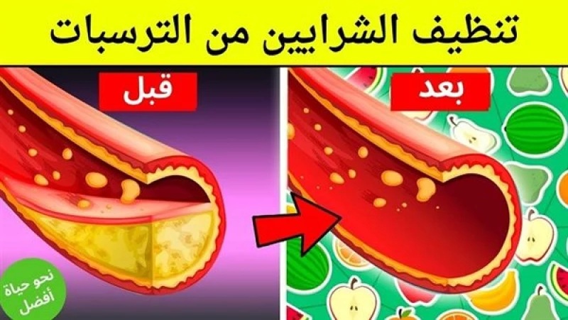 استخدم هذا العشبه الجبارة لتنظيف الشرايين من الدهون المتراكمة حتي لو كانت منذ سنوات؟!